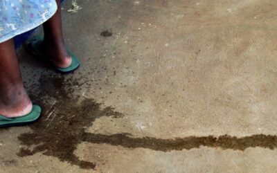 International Day to End Obstetric Fistula 2026