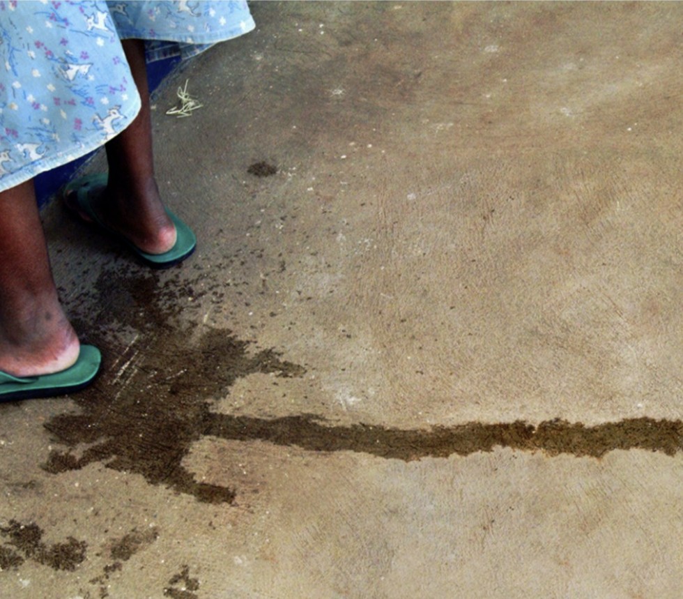 International Day to End Obstetric Fistula 2026